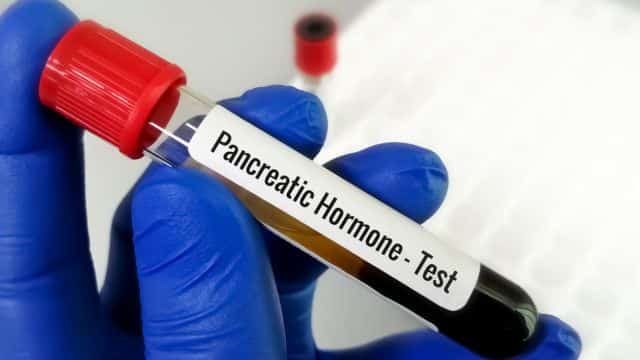 pancreatitis in dogs topper petrage (1)