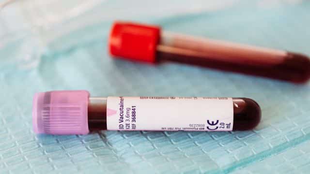 protozoal infections in canines topper (2)